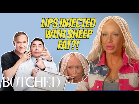 Ashley Has SHEEP FAT Injected In Her Lips?! (Before & After) | Botched | E!