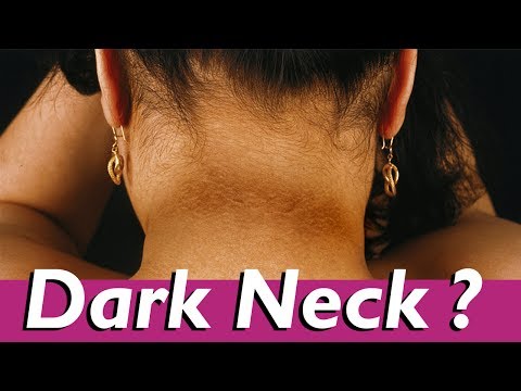 Tips to remove Neck Black – Effective Home Remedies To Get Rid Of A Dark Neck – Tamil Beauty Tips