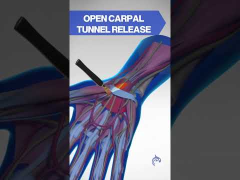 Guess The Spine Injury And Procedure Challenge