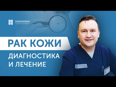 Признаки и современные методы лечения рака кожи. Hadassah Medical Moscow