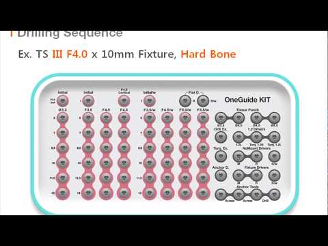 Osstem - OneGuide KIT