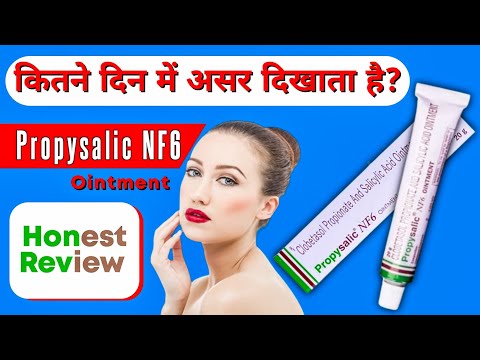 20g Clobetasol Propionate Salicylic Acid Ointment, Packaging Size: 20 gm