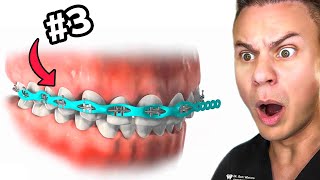 Top 5 Most PAINFUL Things About Braces!
