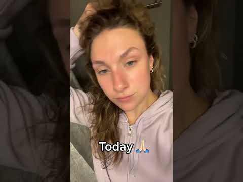 The photos speak for us 🙌🏼🩵 #clearstemskincare #beforeandafter #acnehelp #skincaretips #glowingskin