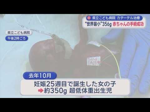 YouTube Video 超低体重出生児356gの赤ちゃんにカテーテル手術成功　妊娠25週で誕生し生後19日で大手術　国内有数小児医療チームが繋いだ小さな命の奇跡　静岡県立こども病院