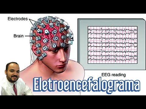 Eletroencefalograma (EEG): o que é, tipos e para que serve o exame?