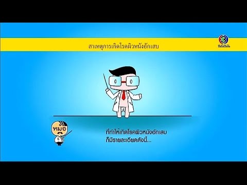 สิ่งที่ถือว่าเป็นกลาก กว่าบรรเทาโรคสะเก็ดเงิน