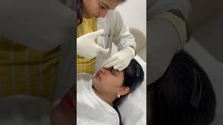 Instant Nose Makeover – Non-Surgical & Painless Rhinoplasty!