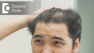 How to treat hair thinning in front part of the scalp? - Dr. Nischal K