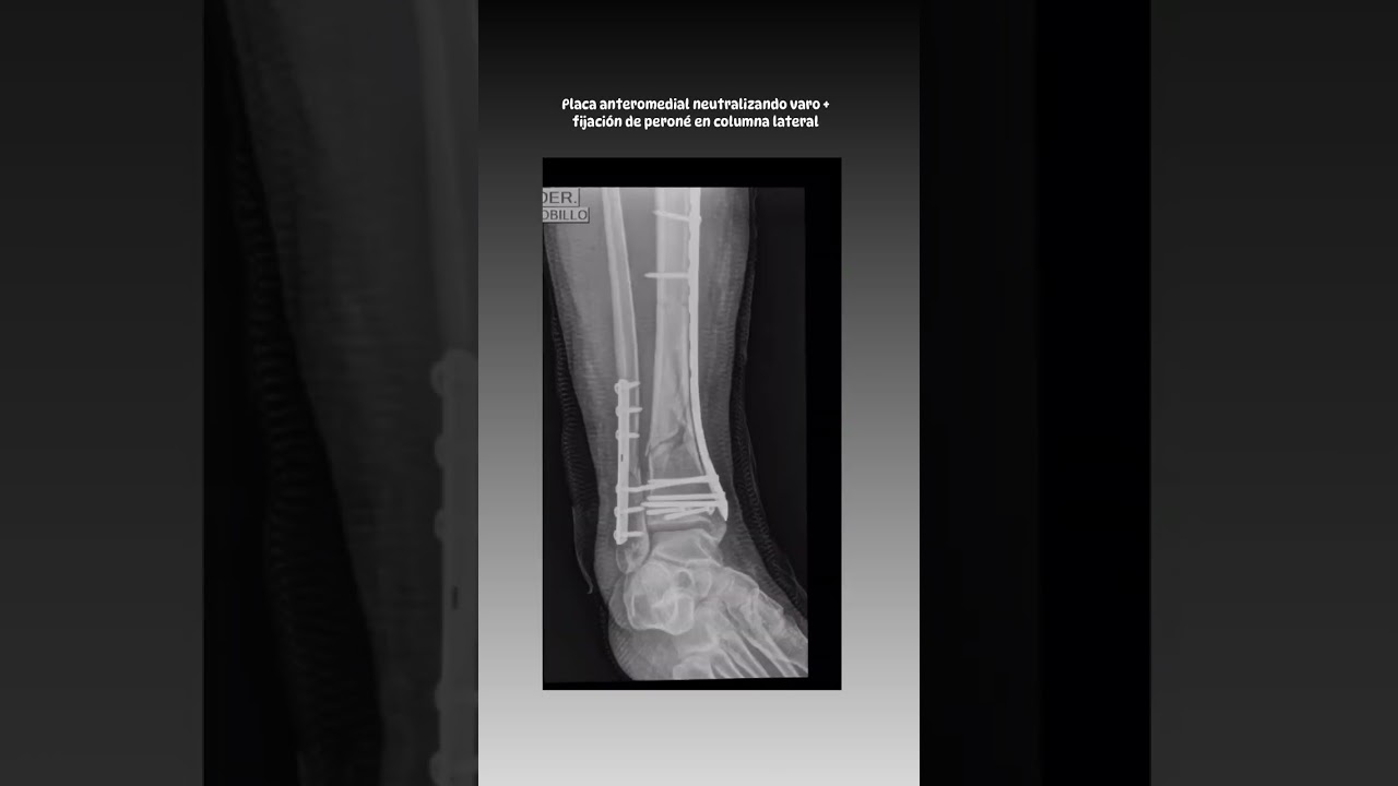 Helberth Augusto González Rico-4