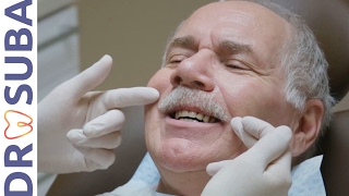 Prothèse clipsée - Prothèse amovible - Dr SUBA Csongor