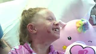 7-year-old treated at Akron Children’s for rare skin condition