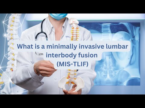 What is a minimally invasive lumbar interbody fusion (MIS-TLIF)