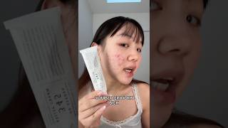 Download lagu Apakah krim 345 sepadan? 🥴Ya! Gunakan kode promo: GRACE888 untuk mendapatkan potongan harga 🙂↕️ #skincare #kbeauty #acne mp3 Download lagu Apakah krim 345 sepadan? 🥴Ya! Gunakan kode promo: GRACE888 untuk mendapatkan potongan harga 🙂↕️ #skincare #kbeauty #acne mp3