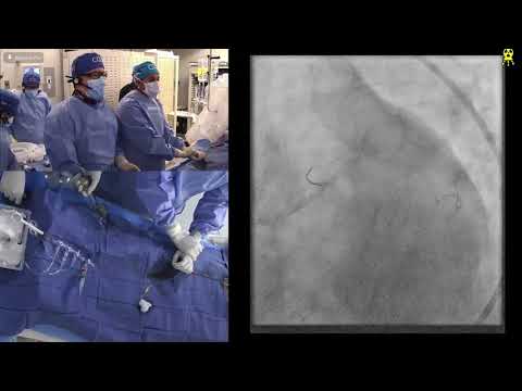 Live Case Presentations #1, #2 and #3