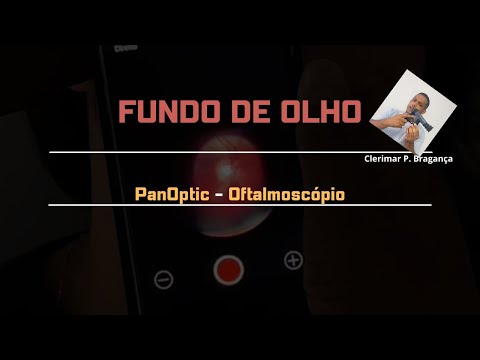Fundo de Olho com o oftalmoscópio PanOptic Welch Allyn