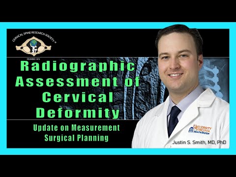 Radiographic Assessment of Cervical Deformity