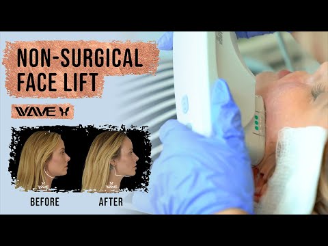 3 Ways To Get A Facelift Without Surgery | FAST and EASY Solution!