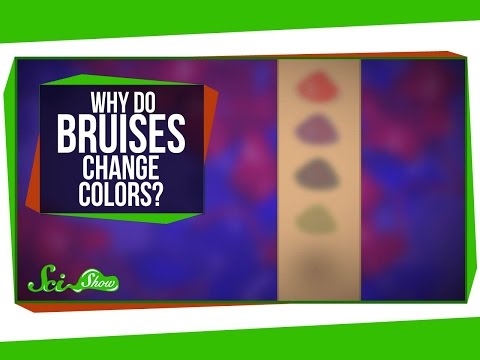 Why Do Bruises Change Colors?