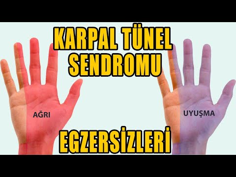 KARPAL TÜNEL SENDROMU EGZERSİZLERİ #aktifizyo #fiziktedavi #elbileği ağrısı