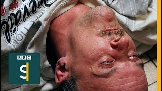 Heroin-ravaged city fighting back (FULL DOCUMENTARY) - BBC Stories
