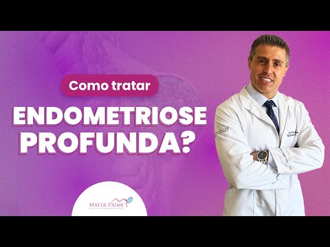 Reproduzir Vídeo