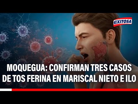 🔴🔵 Moquegua: Confirman tres casos de tos ferina en Mariscal Nieto e Ilo