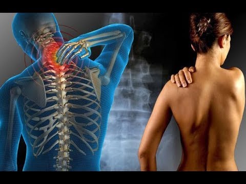 Come rimuovere il dolore alla schiena severo Come utilizzare argilla blu per il trattamento dei giunti