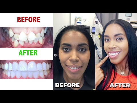 Vimeo Video Title #2