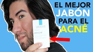 EL MEJOR JABON PARA ELIMINAR EL ACNE Y PIEL GRASA - J.M. Montaño
