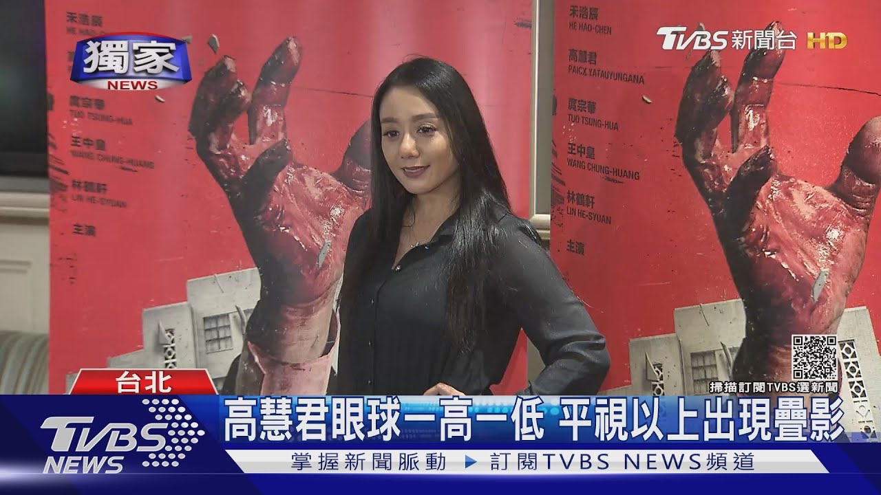健康亮紅燈!高慧君免疫出問題 眼球一高一低 辭演舞台劇