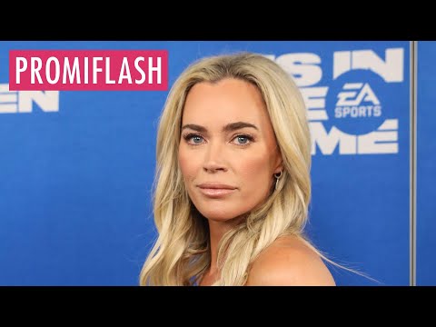 Video Thumbnail: OP geplant: Bei Teddi Mellencamp wurden Hirntumoren entdeckt