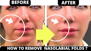 🛑 HOW TO GET RID OF  NASOLABIAL FOLDS WITH FACE YOGA ? JOWLS, SAGGY SKIN, FOREHEAD LINES, EYE BAGS