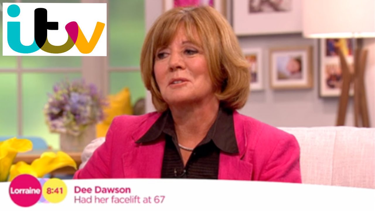 ITV Lorraine Show Featured patient of Dr. Julian De Silva, underwent Natural Face and Neck lifting