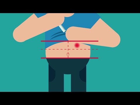 Basics of Insulin Therapy (English subtitles)