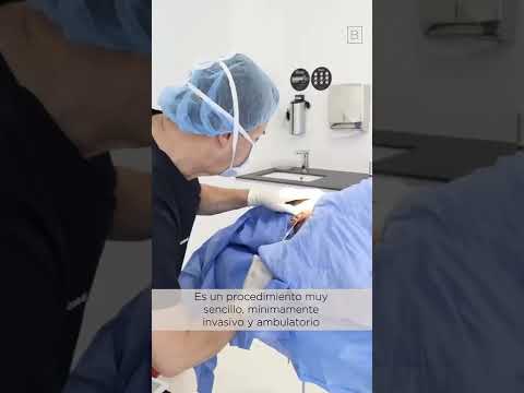 Lipopapada en el Centro Dermatológico Giovanni Bojanini en Bogotá