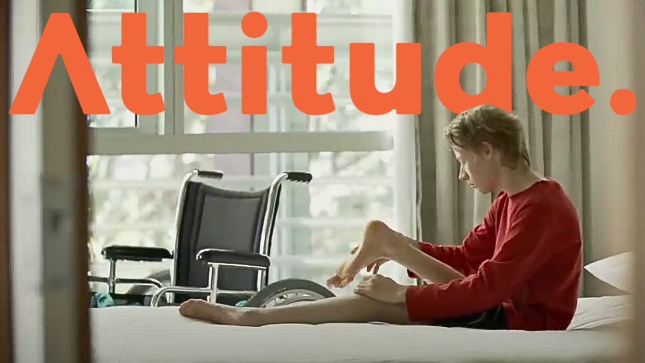 Rotationplasty: Life With a Backwards Foot