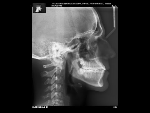 FL STUDIO OHSI ESPERANDO LOMO