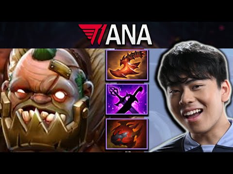Pudge Dota 2 Gameplay T1.Ana with 28 Kills and Kaya - Sange