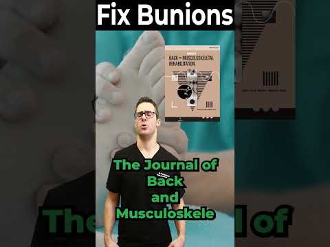 TOP 13 Ways to Shrink Bunions Naturally 1 HUGE SECRET