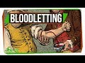 Why Do Some Doctors Still Use Bloodletting?