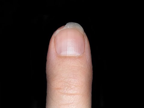 58 Days Nail Growing