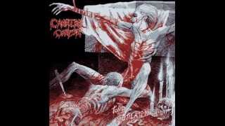 Cannibal Corpse - Post Mortal Ejaculation 8-Bit