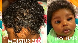How To Moisturize &amp; Grow Baby’s Hair | Or Remove Cradle Cap DETAILED