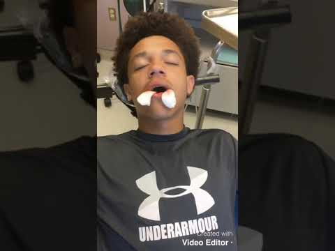 Trent gets his wisdom teeth removed