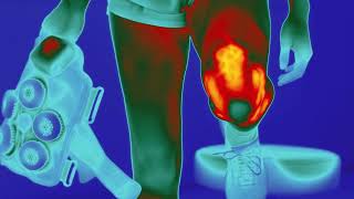 Product video: Hyperice X Knee Hot & Cold Contrast Therapy Device