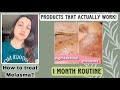 how to remove melasma best products to treat pigmentation hyperpigmentation routine for brown skin