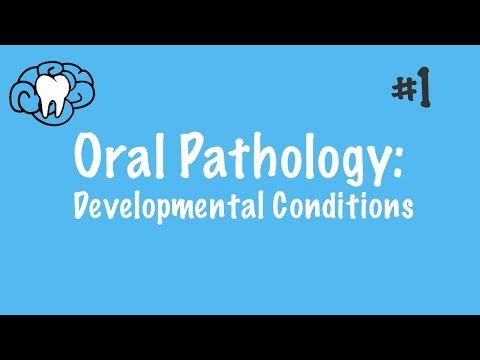 Oral Pathology | Developmental Conditions | INBDE, ADAT