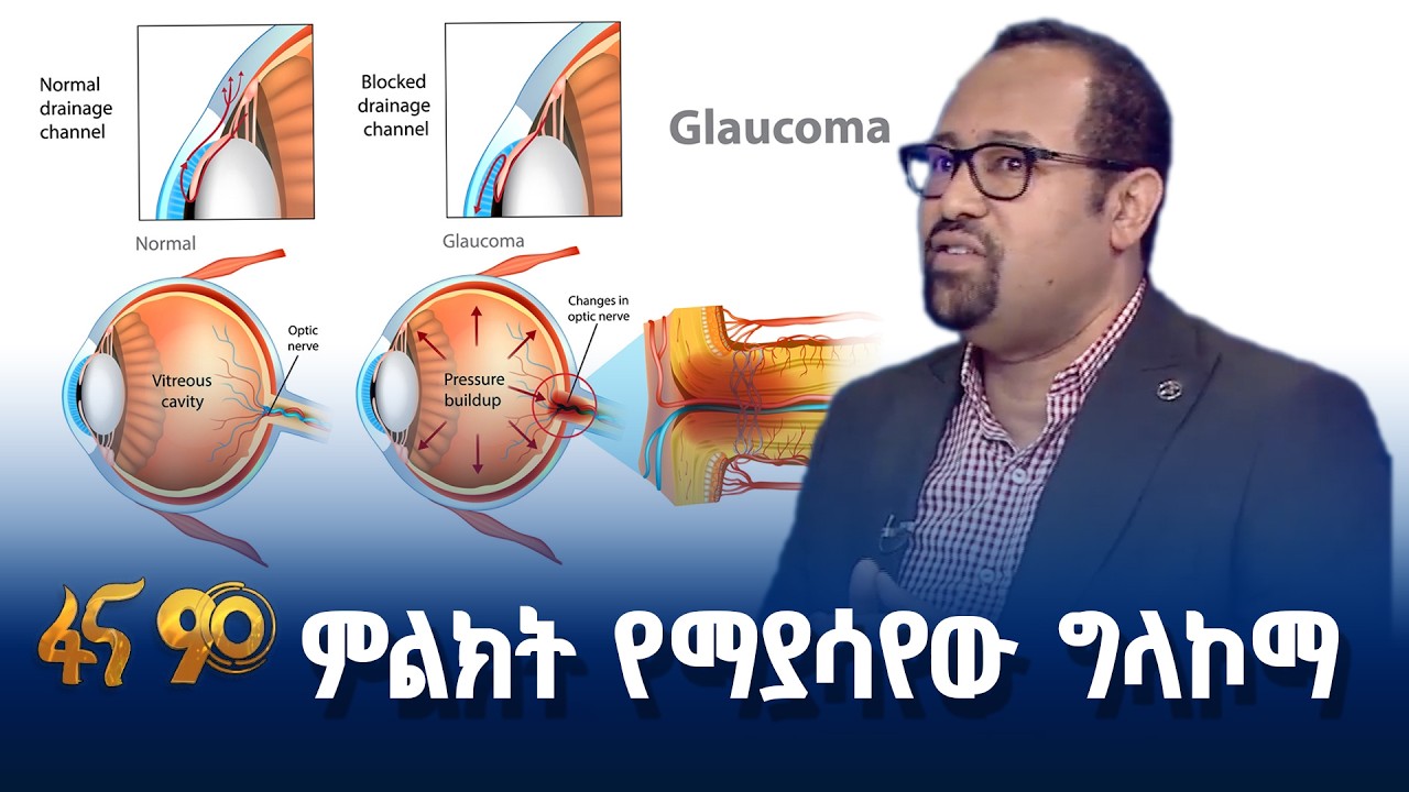 በዘር የሚተላለፈው ግላኮማ