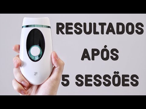 Thumbnail do Youtube